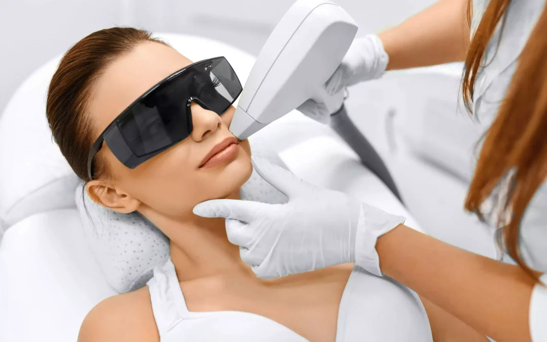 Épilation définitive au laser du visage pour une peau impeccable