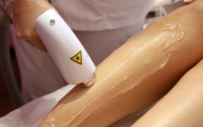 Épilation définitive au laser pour un corps lisse et sans poils